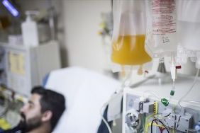 Periton diyalizin tarihçesi