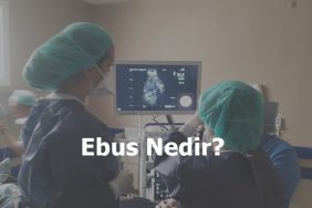 Ebus Nedir?